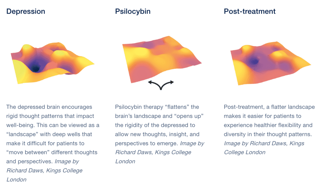 psilocybin effect on depression