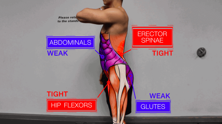 Anterior pelvic tilt caused by sitting