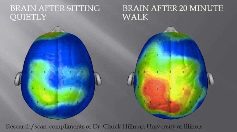 Brain scan after walking exercise
